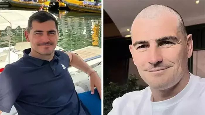 Kasilyasın yeni görünüşü sosial mediada gündəm oldu